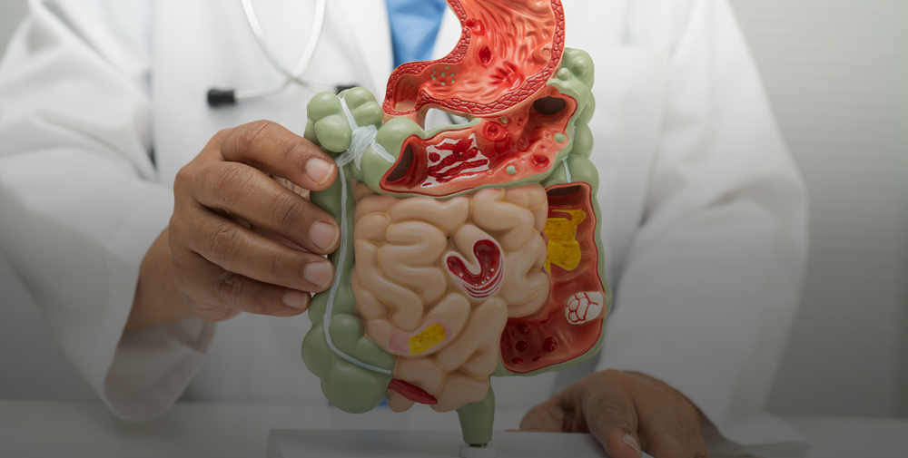 Healing Your Digestive System – No Bloat